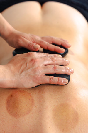 Hot stone massage therapy on back for relaxation and muscle pain reliefの写真素材