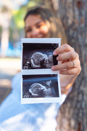 Pregnant woman holding ultrasound photo looking at camera outdoors in parkの写真素材