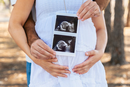 Pregnant couple showing ultrasound photo of baby near belly outdoors.