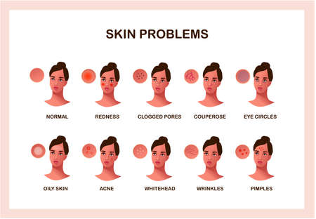 Skin problems vector concept. Skin health and careのイラスト素材