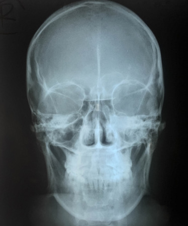 film skull AP viewの写真素材