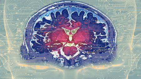 Abstract background of brain image from MRI