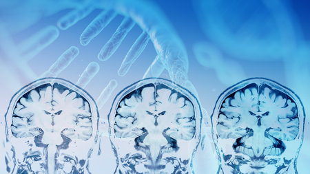 magnetic resonance image (MRI) of the brain overlay with DNA strain