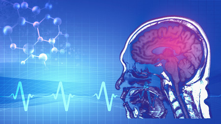 abstract background of magnetic resonance image (MRI) of brain with abstract symbol of pulse and humen gene in concept of brain sickness cause from geneの写真素材