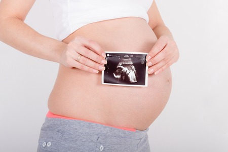 Body of young pregnant woman / teenager with ultrasound image of her unborn childの写真素材