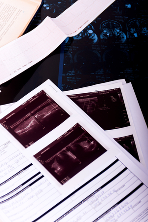 Medical workplace. Close-up of application form with ultrasonography, x-ray image and electrocardiogram on doctor's tableの写真素材