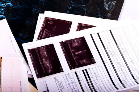 Medical workplace. Close-up of application form with ultrasonography, x-ray image and electrocardiogram on doctor's tableの写真素材