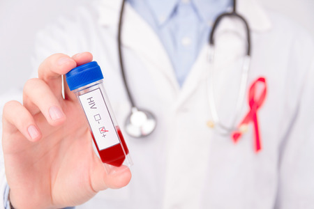 AIDS / HIV disease concept. Doctor wearing white coat and blue rubber medical gloves with pinned red ribbon as a symbol of aids / hiv and stethoscope holding negative tumor marker / blood test.の写真素材