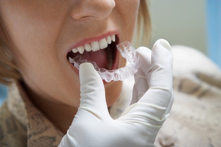 Woman Getting Dental Mold Madeの写真素材