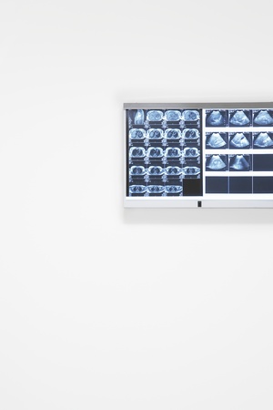 X-rays and ultra sound results hanging on wallの写真素材