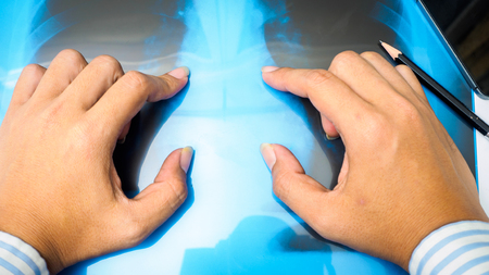 Man hand pointing fingers on x-ray film.の写真素材