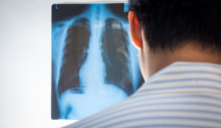 Doctor looking x-ray film isolated white background