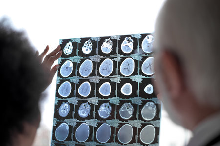 Picture of an x-ray of a brain being discussed by two medical workers, at the hospital.の写真素材