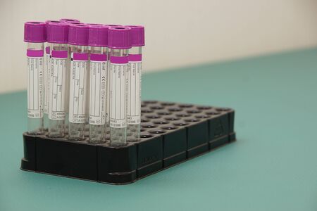 A set of transparent test tubes stands on a table in a medical office.