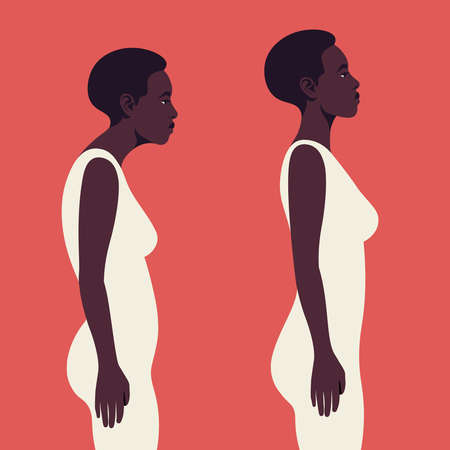 An African woman with a bad posture. Spine. Profile. Kyphosis. Flat vector illustration on red background. Minimalismのイラスト素材