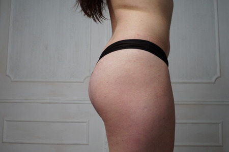 Beautiful slim woman's body. Perfect slim toned young body of the girl. Fitness or plastic surgery...