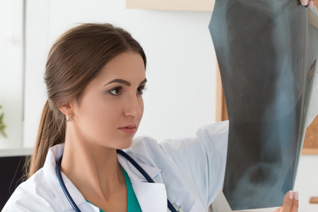 Young female doctor looking at lungs x-ray image. Healthcare and medical conceptの写真素材