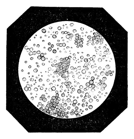Fat Globules as seen under a Microscope, vintage engraved illustration. Usual Medicine Dictionary by Dr Labarthe - 1885のイラスト素材
