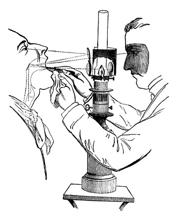 Laryngoscope, illuminated by direct sunlight, showing a doctor looking into a patient's mouth, vintage engraved illustration. Usual Medicine Dictionary by Dr Labarthe - 1885のイラスト素材