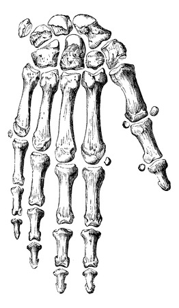 Skeleton of the hand and fingers, vintage engraved illustration. Usual Medicine Dictionary - Paul Labarthe - 1885.のイラスト素材