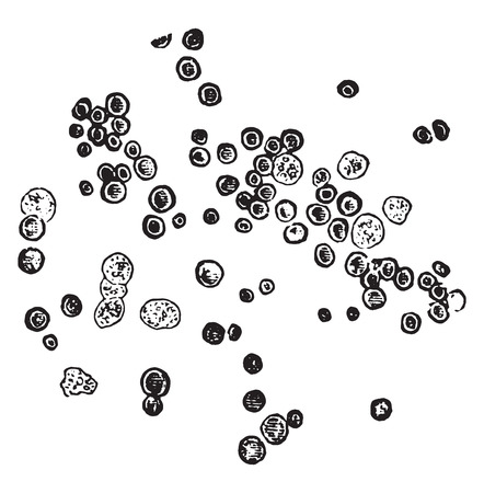 Types of red blood cells, also leukocytes, vintage engraved illustration.のイラスト素材
