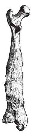 Femur, longitudinal section of bone, vintage engraved illustration.のイラスト素材