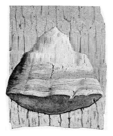 Polyporus fomentarius, vintage engraved illustration.の写真素材