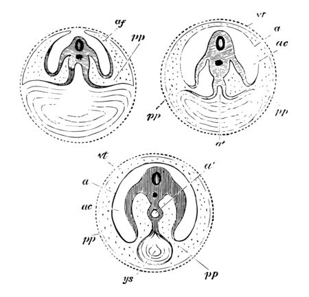 Development of the Yolk Sac which is seen progressively diminishing in size vintage line drawing or engraving illustration.のイラスト素材