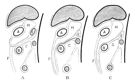 This diagram represents Development of the Great Omentum, vintage line drawing or engraving illustration.のイラスト素材