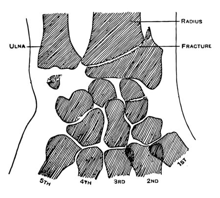 This illustration represents Colle Fraction of the Radius, vintage line drawing or engraving illustration.のイラスト素材