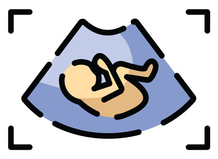 Pregnancy ultrasound, illustration, vector on a white background.のイラスト素材