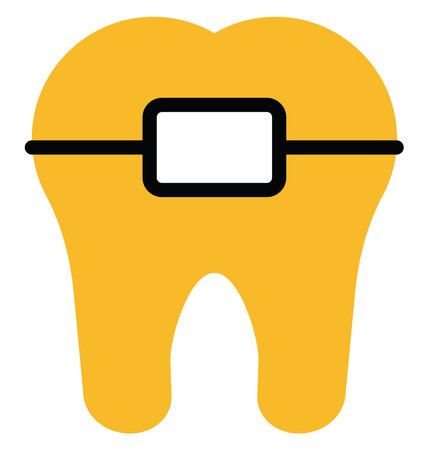 Dentist braces, illustration, vector on a white background.のイラスト素材