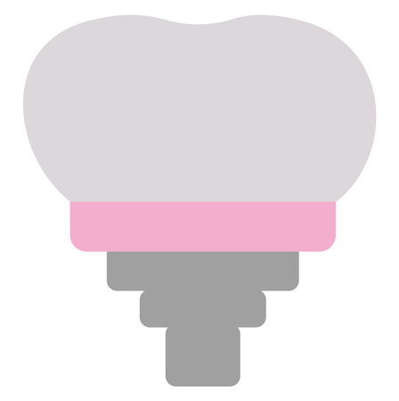 Medicine dental implant, illustration, vector on a white background.のイラスト素材