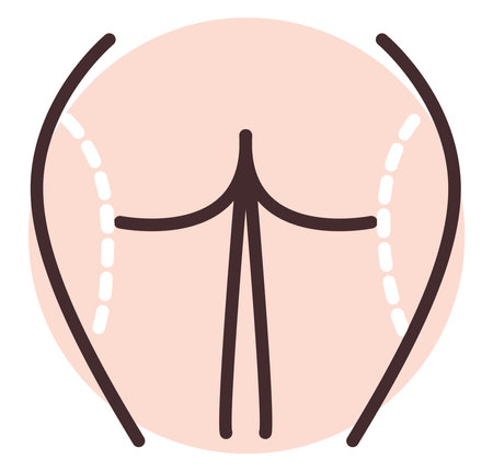 Hip slimming surgery, illustration, vector on white background.の写真素材