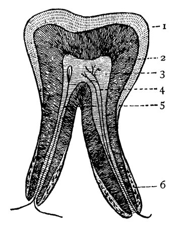 A typical representation of the vertical section of a tooth, with parts showing, 1: Enamel; 2: Dentine; 3: Pulp; 4: Blood-vessel; 5: Nerve and 6: Fibrous cement, vintage line drawing or engraving illustration.のイラスト素材