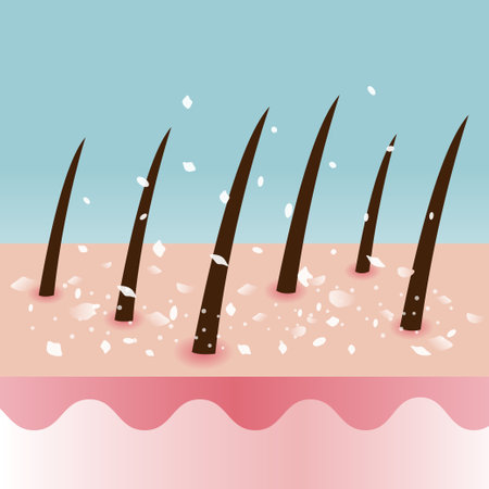 Diagram of dandruff hair on scalp layer vector illustration on aqua blue green background. The dead skin cells, scaly scalp and white dry flaky in hair. Hair care and problem concept.のイラスト素材