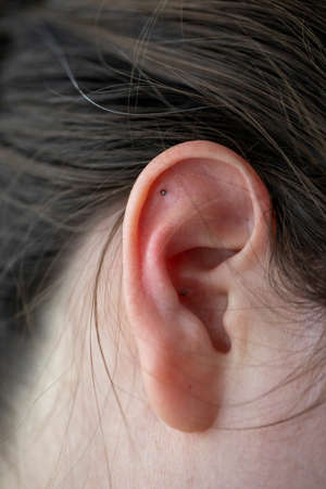 A sideways portrait of the ear of a woman with acupressure ear seeds in it. The three metal balls...