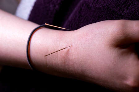 A portrait of a few thin acupuncture needles just below the wrist, put in place by an acupuncturist. This alternative medicine treatment is used for healing, relaxing, stimulation and stress relief.の写真素材