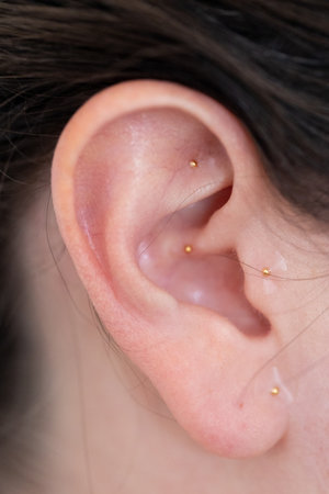 Close-up of a woman's ear with metal acupressure seeds, used in holistic therapy to reduce stress, relieve tension, and promote healing.の写真素材