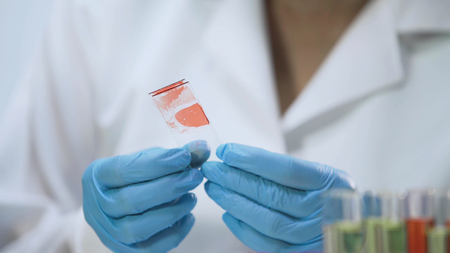 Medical worker analyzing microbiological specimens, blood sample, HIV testの写真素材