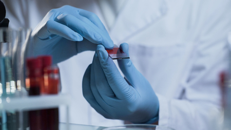 Research analyst connecting two slides with blood sample for macro examinationの写真素材