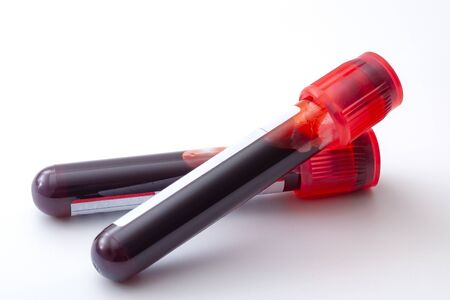 Phlebotomy, biochemical analysis, laboratory exam and blood testing concept theme with two test...