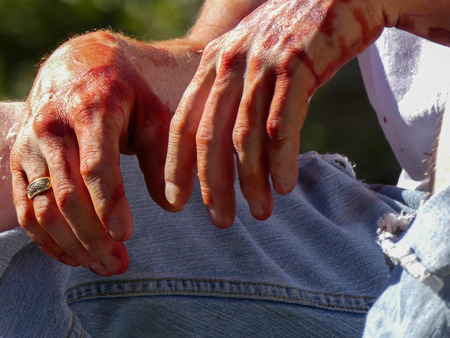 Concept victim terrorist attack injured man street crime victimの写真素材