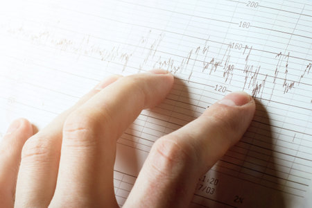 The human hand and medical chart closeup. medical background. The Clinician or patient holds in his hand a cardiogram. sun lightの写真素材