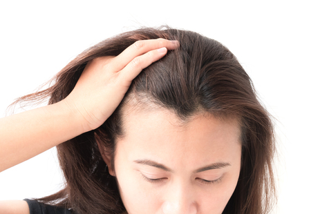 Woman serious hair loss problem for health care shampoo and beauty product conceptの写真素材