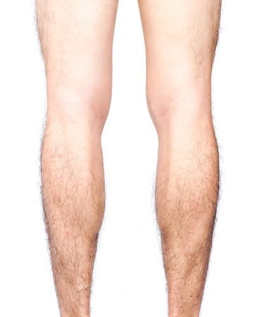 Closeup back of legs men skin and hairy with white background, health care and medical conceptの写真素材