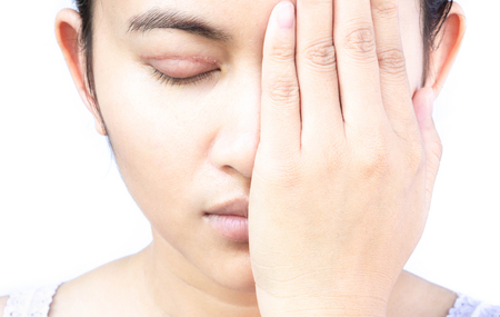 Closeup woman face with eyelid surgery, healthy and beauty conceptの写真素材