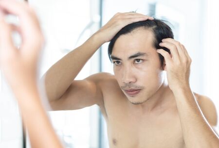 Close up man looking reflection in the mirror serious hair loss problem for health care shampoo and beauty product conceptの写真素材