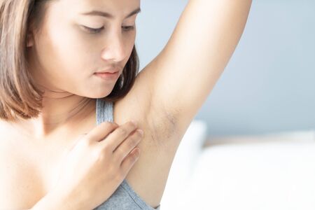 Women problem black armpit lying on white bed background for skin care and beauty concept, selective focusの写真素材