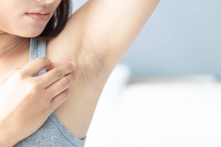 Women problem black armpit lying on white bed background for skin care and beauty concept, selective focusの写真素材